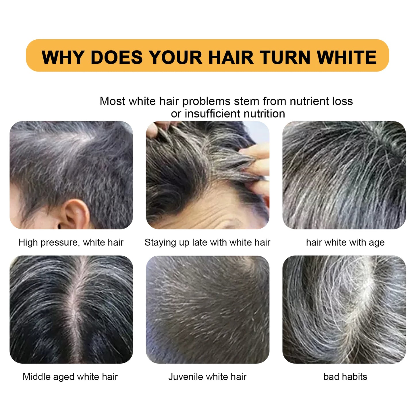 Jaysuing 50g Polygonum Multiflorum Hair Shampoo Soap Darkening Repair Gray White Hair To Black Anti Dandruff Black Hair Dye Soap