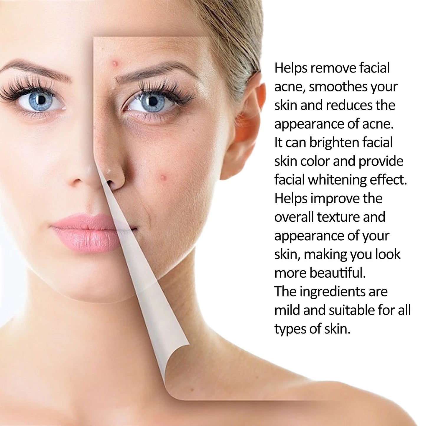 Eelhoe Tea Tree Oil Essence For Acne Scar Reduction Serum