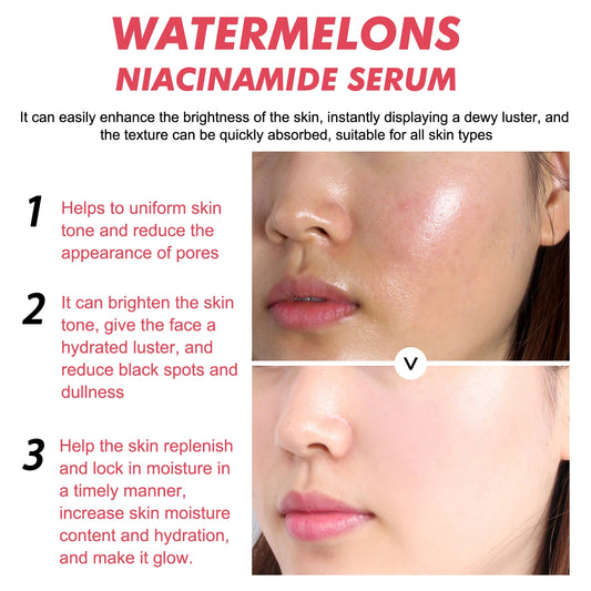 EELHOE 60ml Watermelon Facial Serum Nourish Brightening Even Skin Tone Moisturizing Acne Melanin Removal Smooth Korean Skin Care