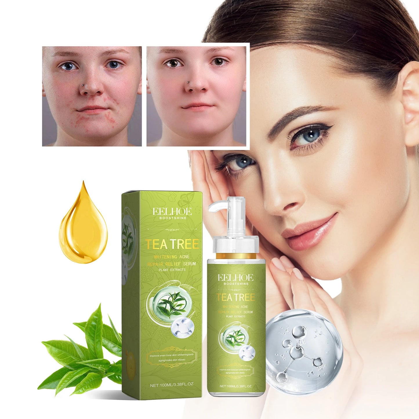 Eelhoe Tea Tree Oil Essence For Acne Scar Reduction Serum