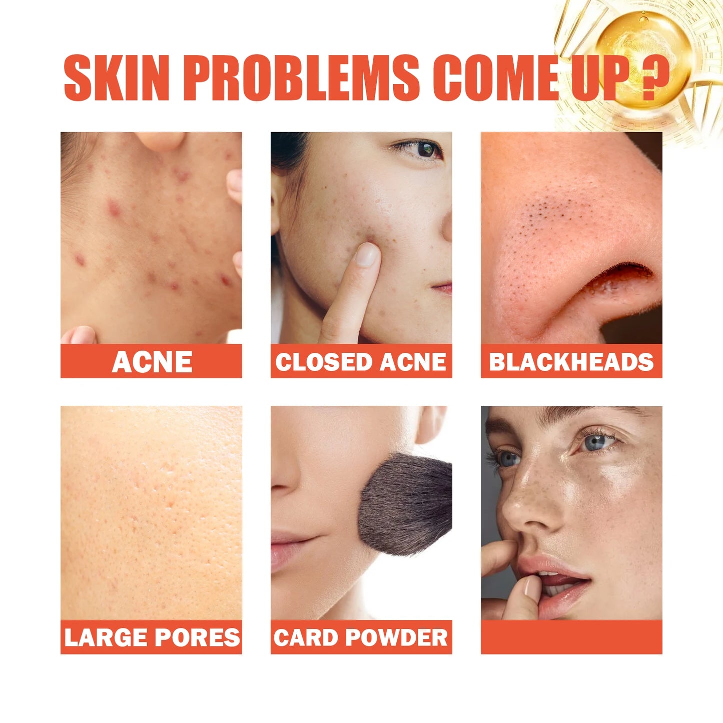 Ouhoe Snail Essence Nourishing Repair Serum For Acne Scars