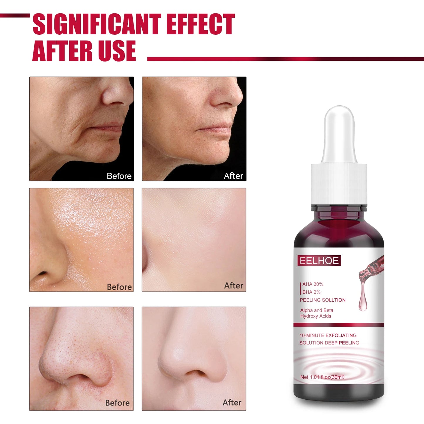 Eelhoe Pore Refining Essence Nose Blackhead Removal Serum