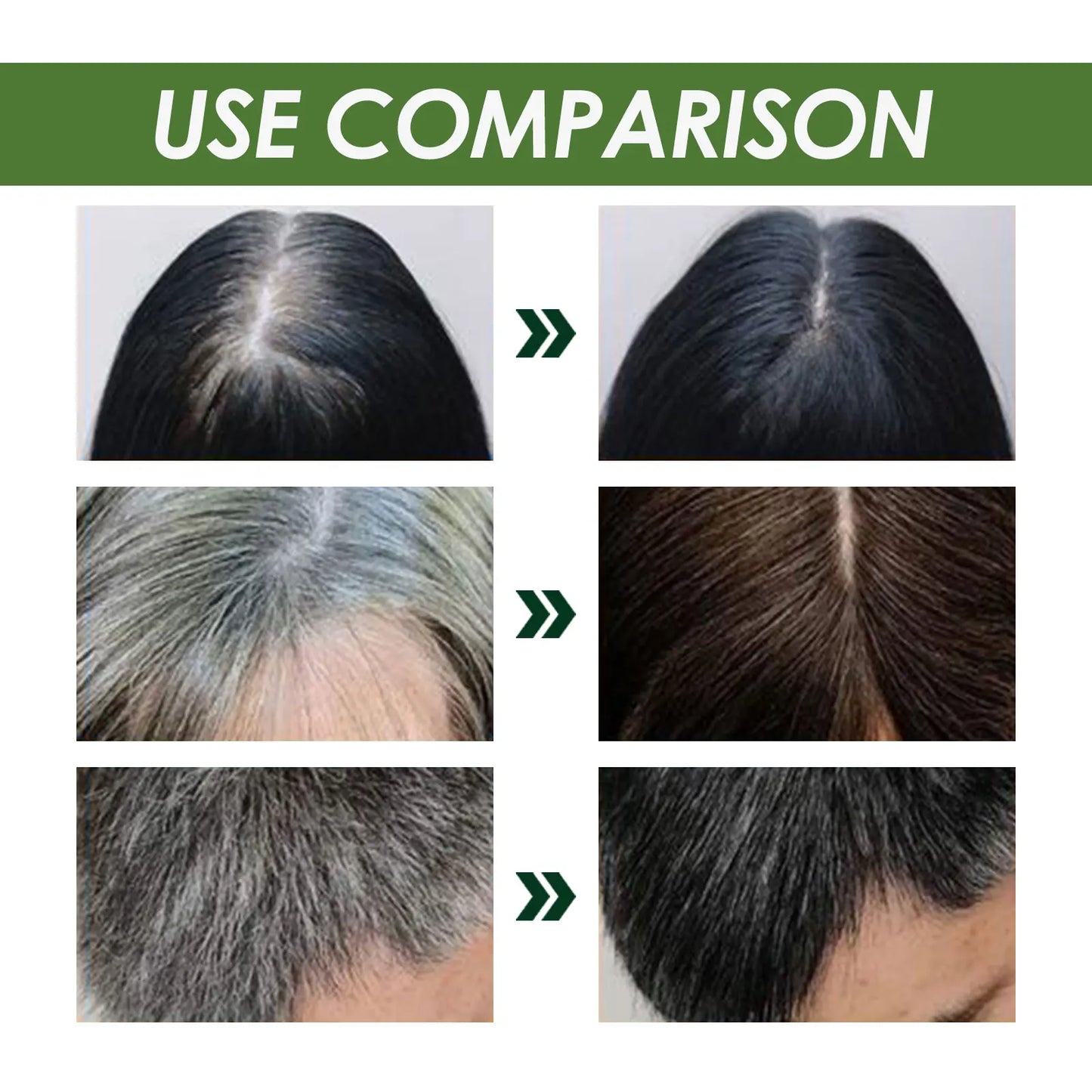 EELHOE Botanical Black Hair Dye Foam Natural Color Long-Lasting Gentle Non-Irritating Treatment for Sensitive Scalp Damaged Hair