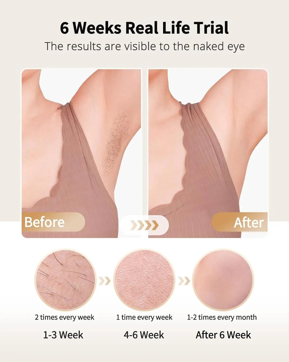 LYSMOSK IPL Laser Hair Removal Epilator With Ice Cooling