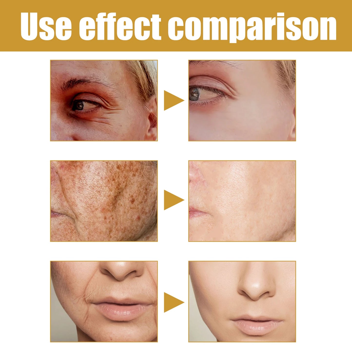 Eelhoe Retinol Anti Wrinkle Essence Capsule Hydrating Facial Serum