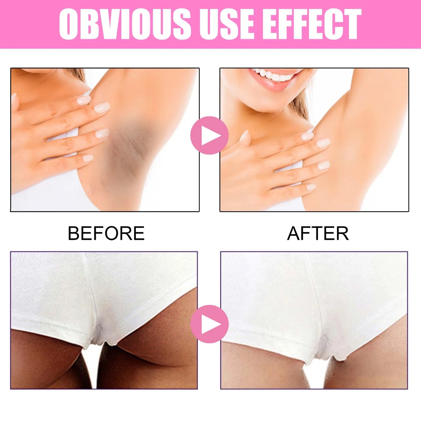 Underarm Bleaching Cream Brightening Dark Private Parts Soothing Chicken Skin Remove Joint Melanin Moisturizing Whitening Cream
