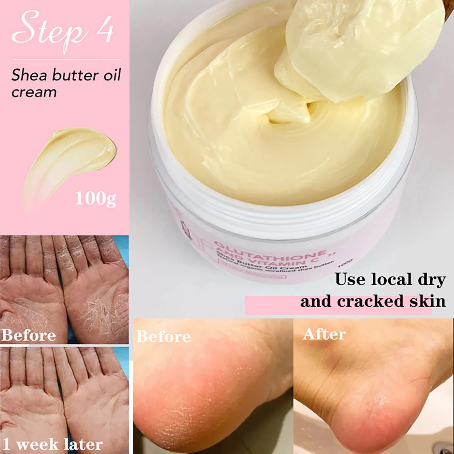 AILKE Glutathione & Vitamin C Shea Butter Cream, Brightening, Deeply Moisturizing, Smooth Skin, Face and Body Butter Cream,100ml